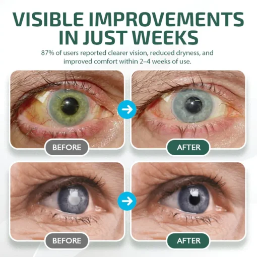 Nano Vision Serum – Cutting-Edge Nano Technology for Crystal-Clear Eyes, No Glasses Needed