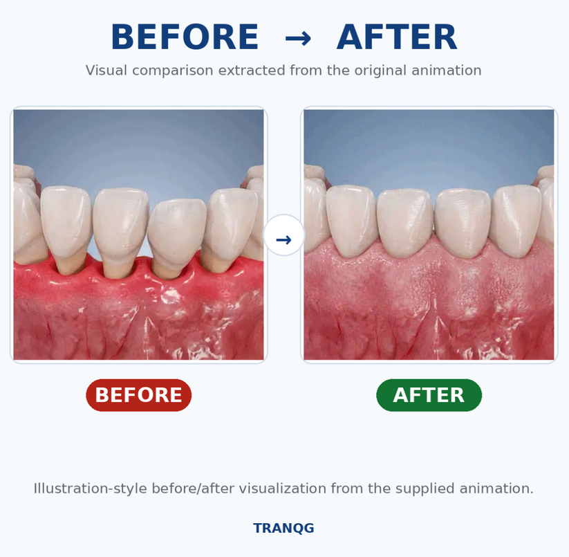 TRANQG GumRevive precision gum care application
