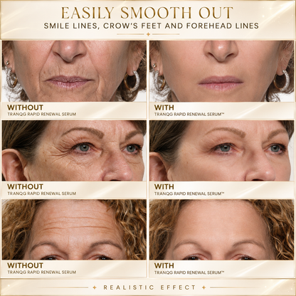 🔆TRANQG™ Instant Face Temporary Tightener – Instant visible results in 60 seconds