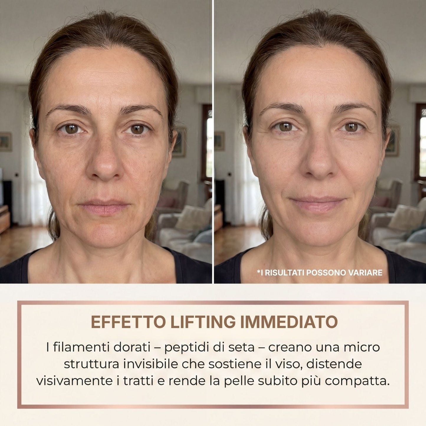 BioChroma – Siero Coreano Effetto Lifting dalla Prima Applicazione