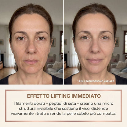 BioChroma – Siero Coreano Effetto Lifting dalla Prima Applicazione