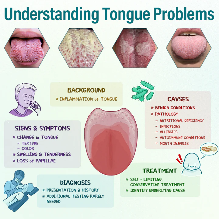 Tongue Repair Spray