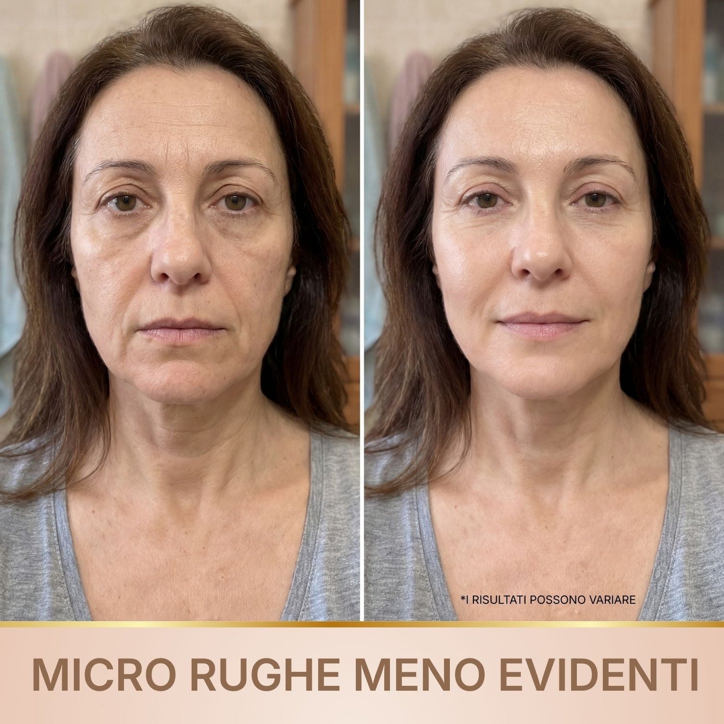 BioChroma – Siero Coreano Effetto Lifting dalla Prima Applicazione