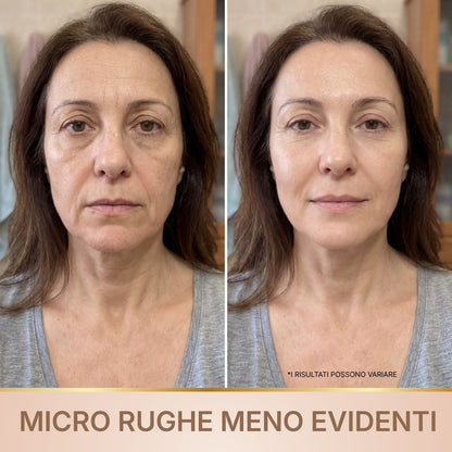 BioChroma – Siero Coreano Effetto Lifting dalla Prima Applicazione