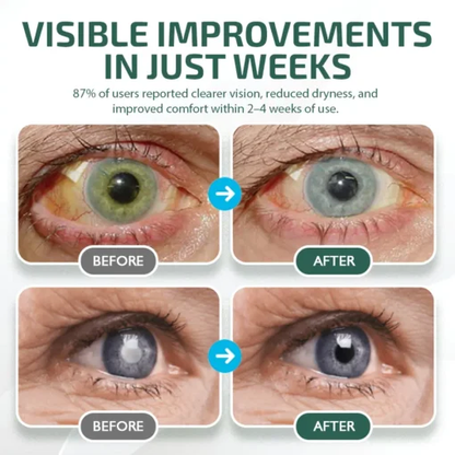 Nano Vision Serum – Cutting-Edge Nano Technology for Crystal-Clear Eyes, No Glasses Needed