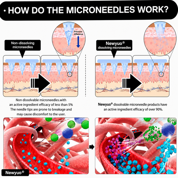 How Newyuo nano microneedles work