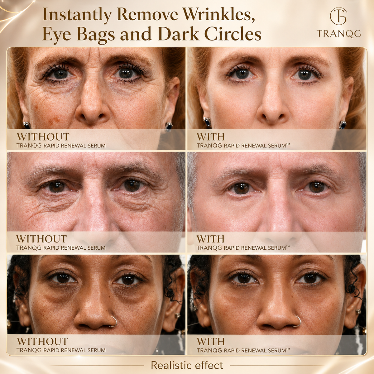 🔆TRANQG™ Instant Face Temporary Tightener – Instant visible results in 60 seconds