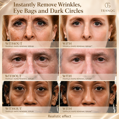 🔆TRANQG™ Instant Face Temporary Tightener – Instant visible results in 60 seconds