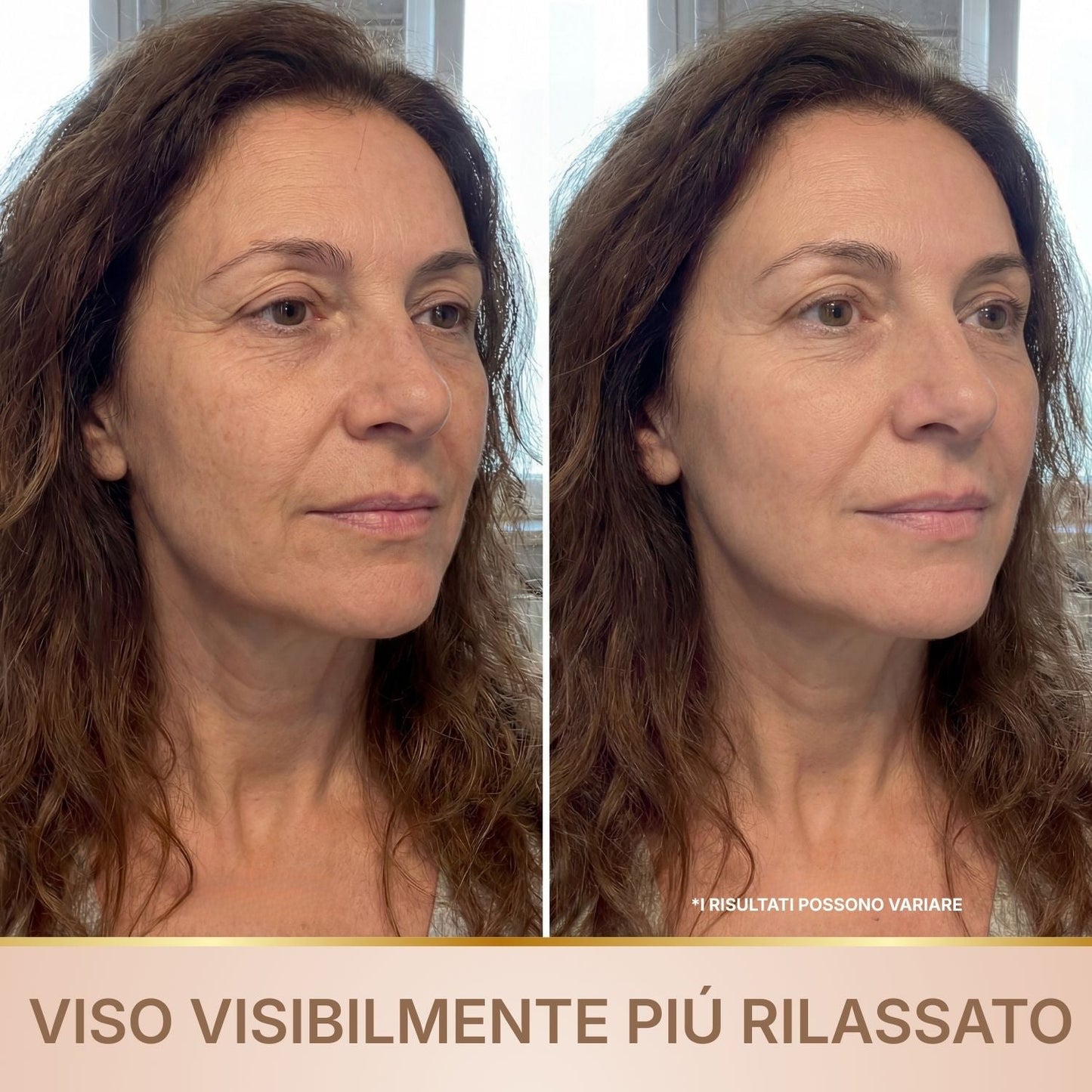BioChroma – Siero Coreano Effetto Lifting dalla Prima Applicazione