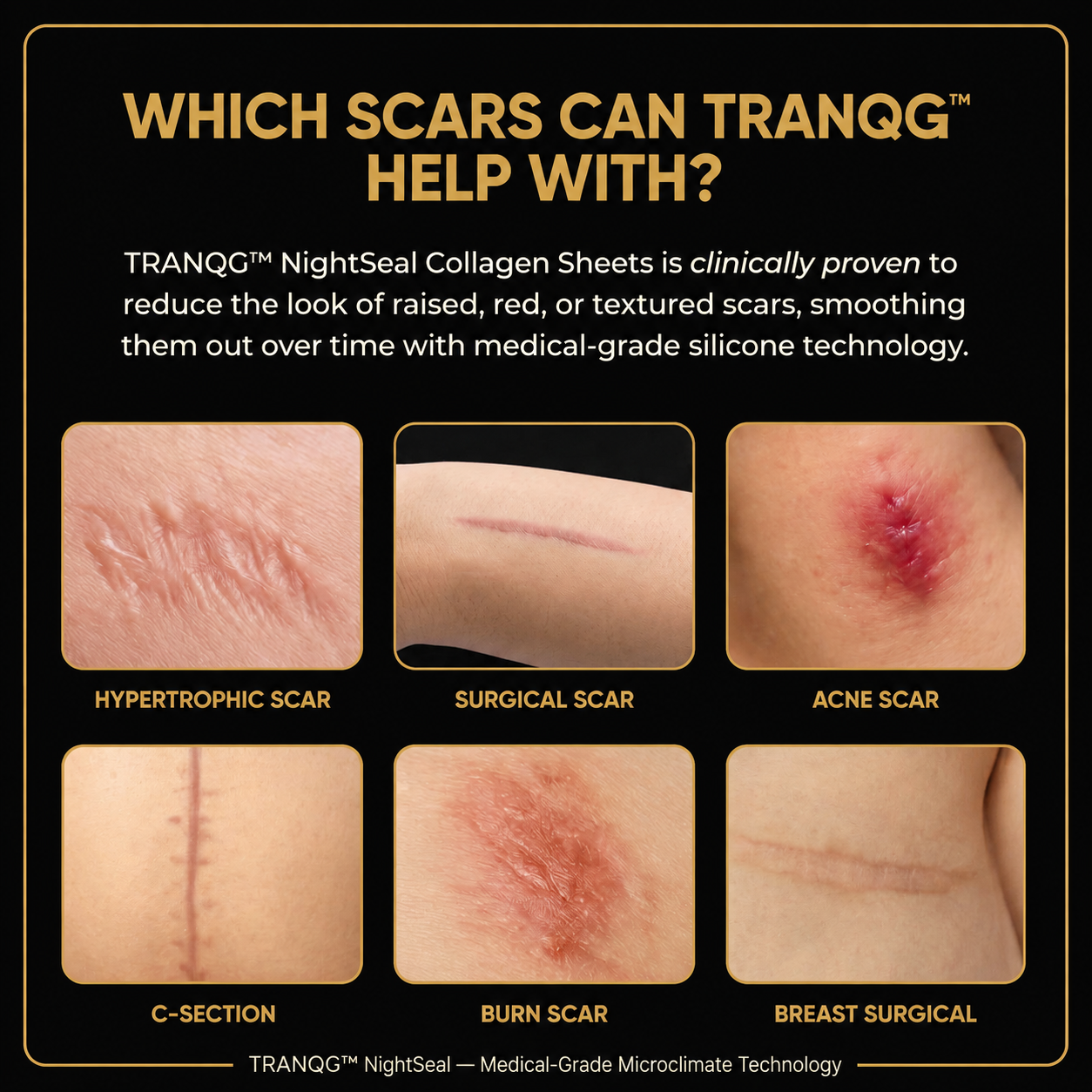 TRANQG™ NightSeal Collagen Sheets
