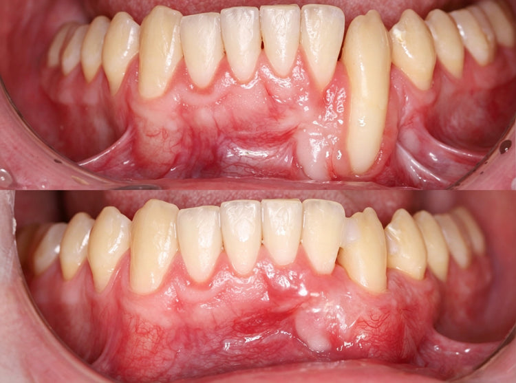 TRANQG GumRevive customer oral care experience