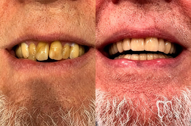 TRANQG GumRevive customer oral care experience