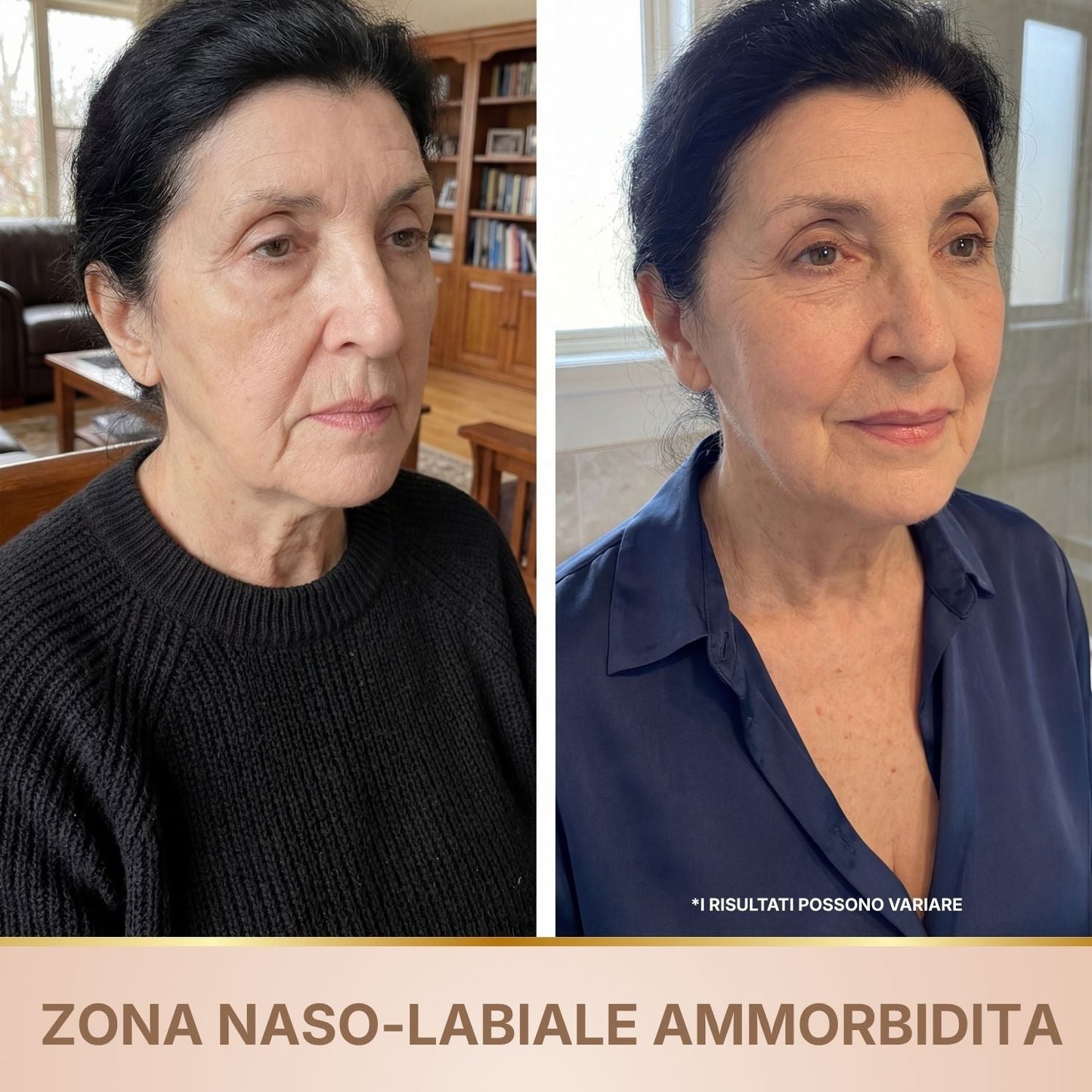 BioChroma – Siero Coreano Effetto Lifting dalla Prima Applicazione