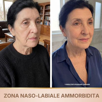 BioChroma – Siero Coreano Effetto Lifting dalla Prima Applicazione