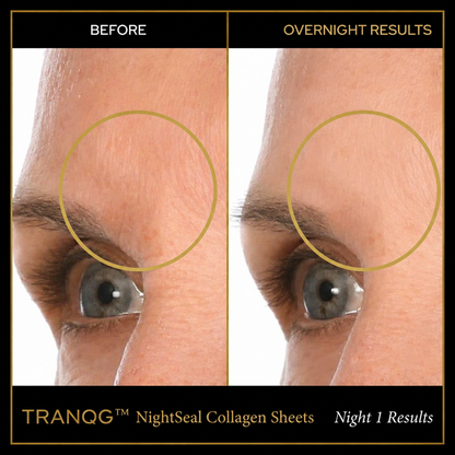TRANQG™ NightSeal Collagen Sheets