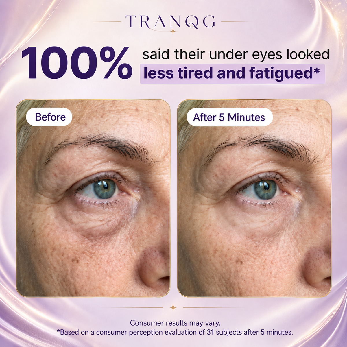 TRANQG™ Instant Lift Eye Gel