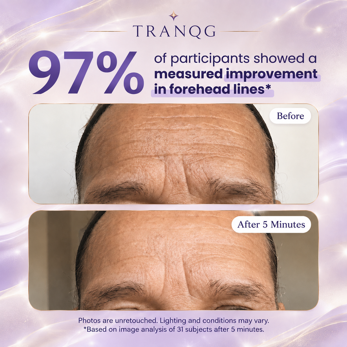 TRANQG™ Instant Lift Eye Gel